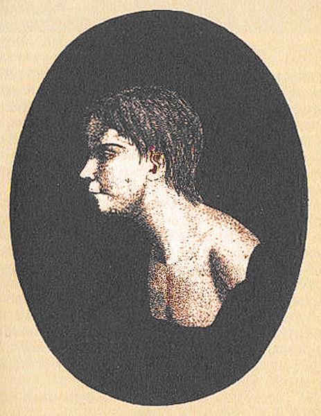 Premier portrait de Victor, décrit comme ayant 26 cicatrices tant au corps qu'à la tête.